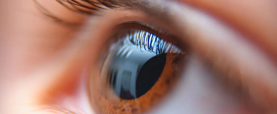 Phakic Lens Implantation