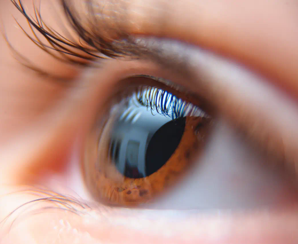 Phakic Lens Implantation